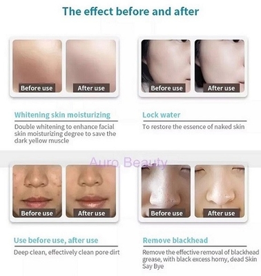 Máquina portátil 7 de Microdermabrasion del Hydra facial en 1 para el salón