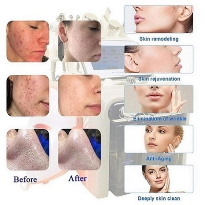 Máquina portátil 7 de Microdermabrasion del Hydra facial en 1 para el salón