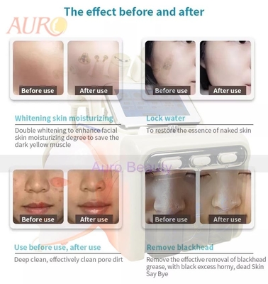 Oxígeno 7 del RF en 1 limpieza facial del cuidado de piel de la máquina de Hydrafacial